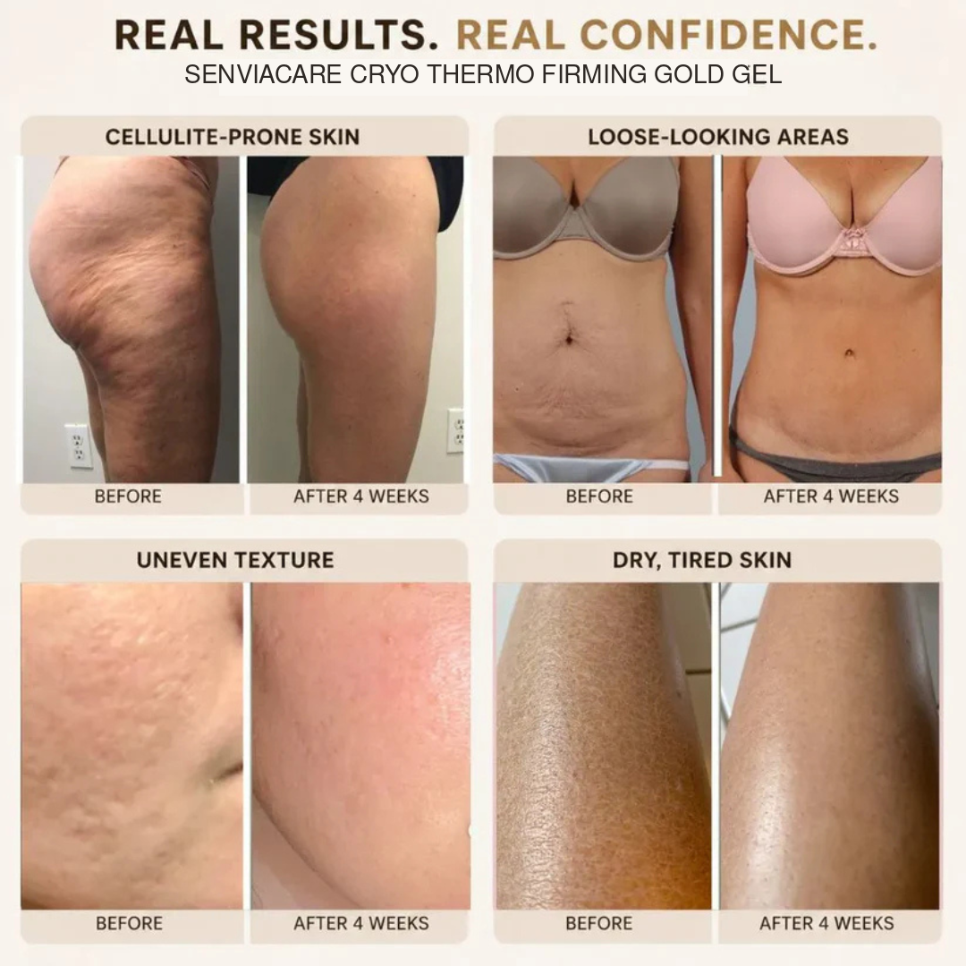 Skin Tightening Cellulite Massage Gel for Body with Cryogold (7.05oz/200G)